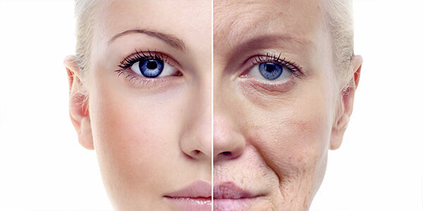 Anti Aging