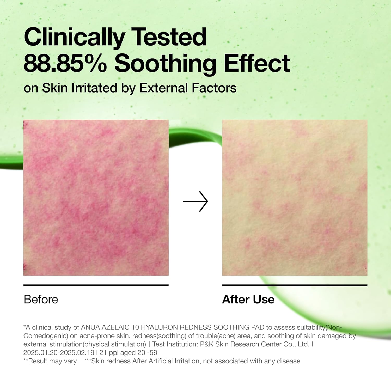 Azelaic Acid 10 Hyaluron Redness Soothing Pad, 90 Pads