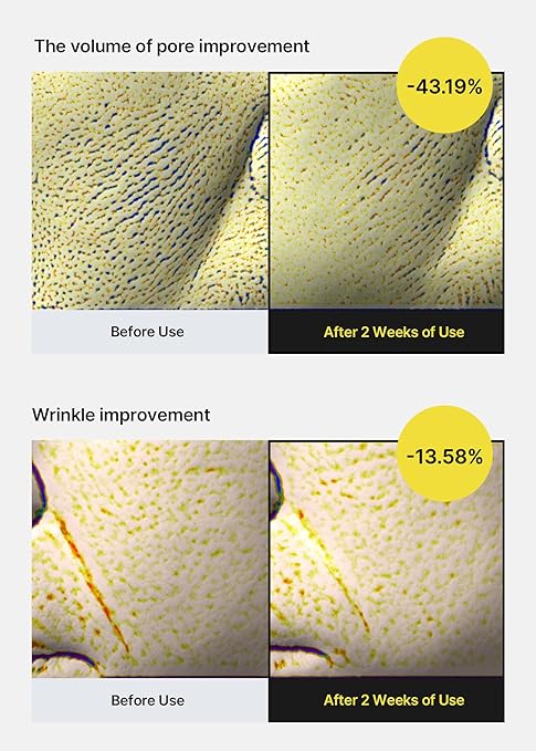 The Vita-A Retinol Shot Tightening Serum, 30ml